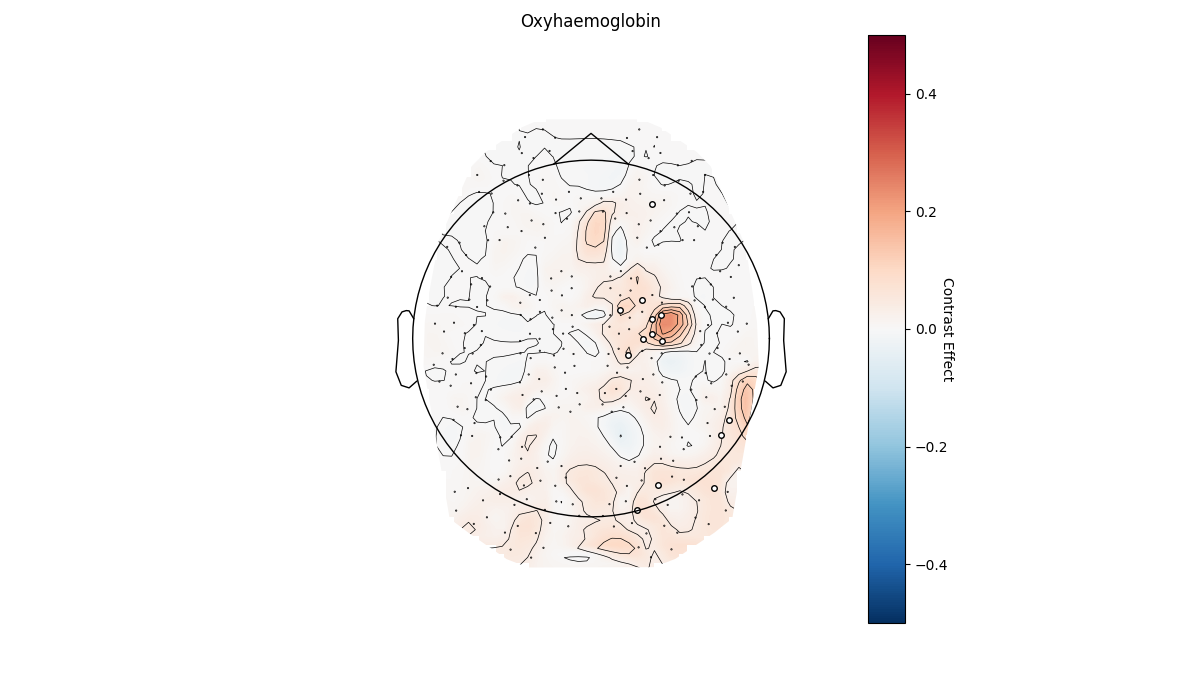 Oxyhaemoglobin