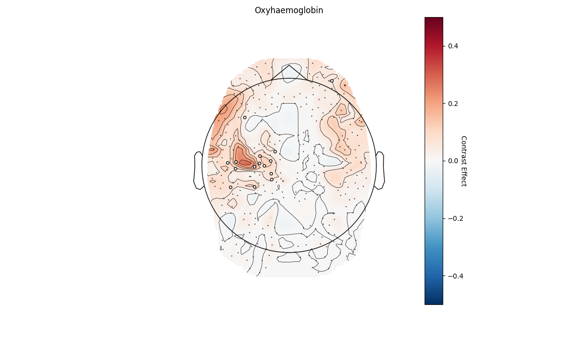 Oxyhaemoglobin