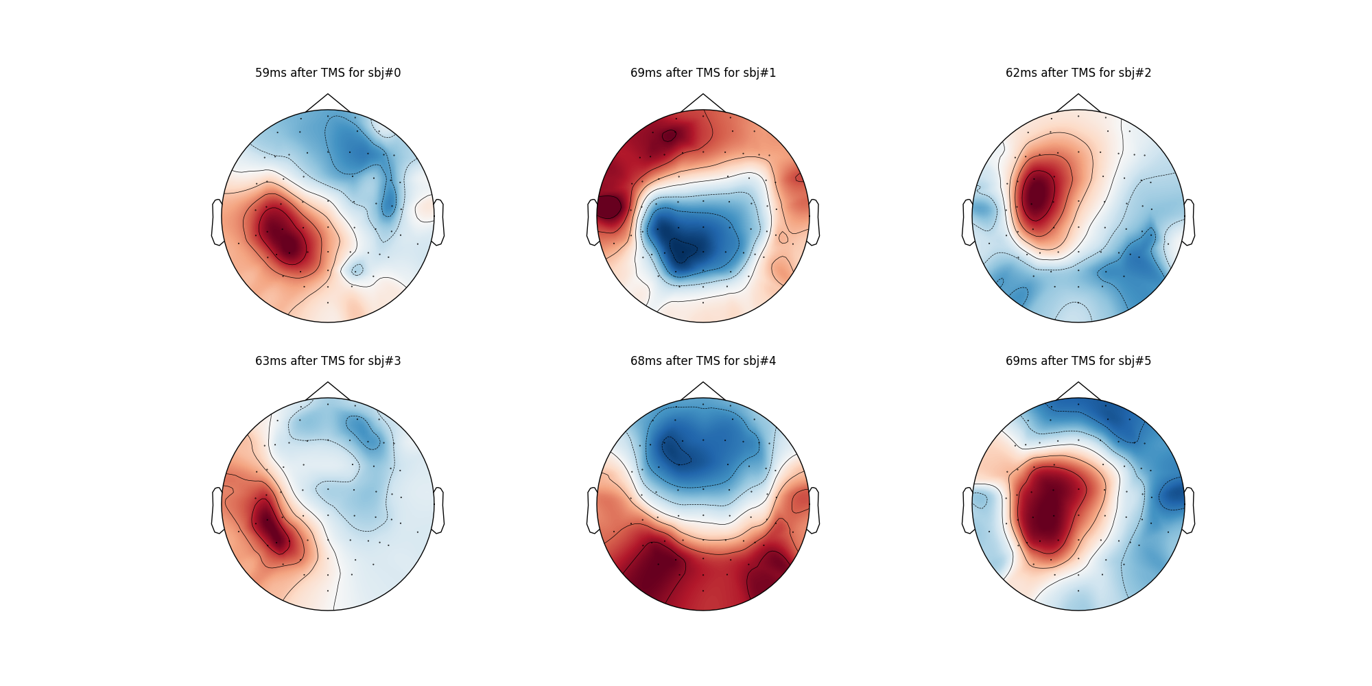 59ms after TMS for sbj#0, 69ms after TMS for sbj#1, 62ms after TMS for sbj#2, 63ms after TMS for sbj#3, 68ms after TMS for sbj#4, 69ms after TMS for sbj#5